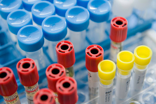 TEST RAPIDI AGLI OPERATORI SANITARI DEL S. ANNA