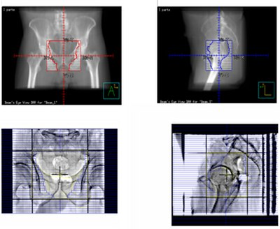 verifica del piano di trattamento verifica del piano di trattamento