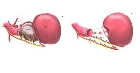 prostata.jpg prostata.jpg