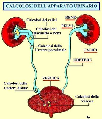 calcolosi dell-apparato urinario.jpg calcolosi dell-apparato urinario.jpg